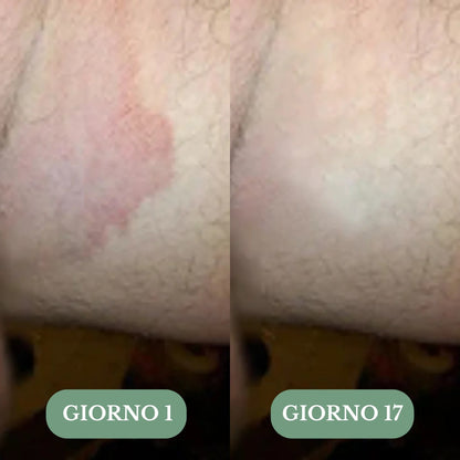 Veloma Sapone Antifungino®