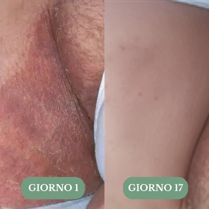 Veloma Sapone Antifungino®